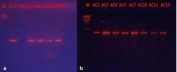 Figura 07: (a) Gel de electroforesis de PCR de bacterias de muestras de suelo; (b) gel  de electroforesis de PCR de bacterias de muestras de agua y suelo, control + fue 