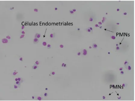 Figura  2 Citología endometrial 