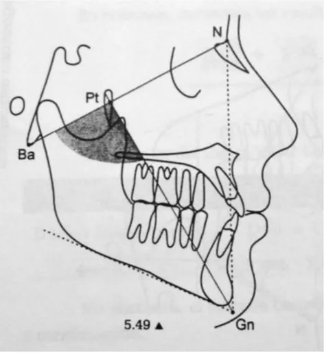 Fig. 10: Angulo del eje facial (Azenha, 2008) 
