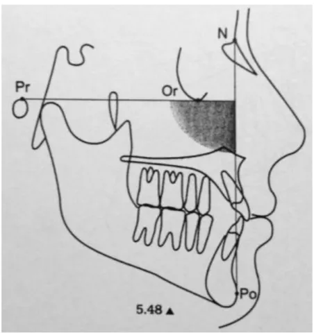 Fig. 11: Profundidad facial (Azenha, 2008) 