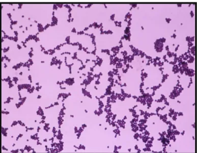 Figura N° 7. Staphylococcus aureus Tinción de Gram. Microscopía óptica. 1000  aumentos