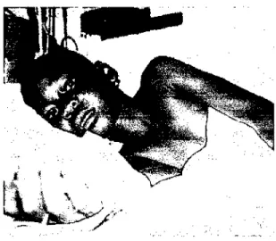 Figura 13:  Paciente con malaria 