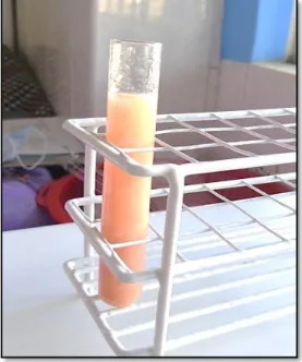 Figura 10: Adición de solución de NaCl antes de centrifugación  Se agitó con una varilla de vidrio durante 1 min