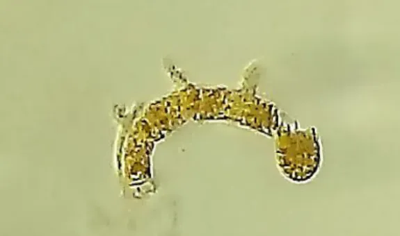Fig. 1. Basidio mostrando tres esterigmas y la basidiospora apical  