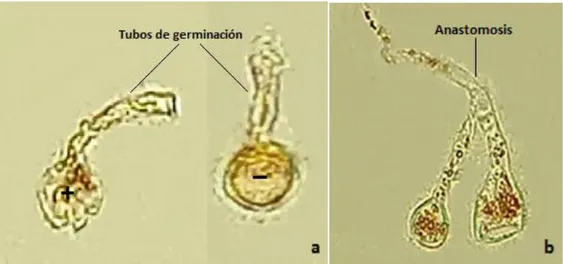 Fig. 3. Basidiosporas de diferente polaridad, mostrando sus tubos de germinación (a); 