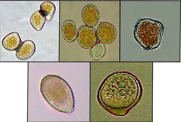 Fig. 14. Formas no frecuentes de teliosporas de Uromyces lupini MSRO  