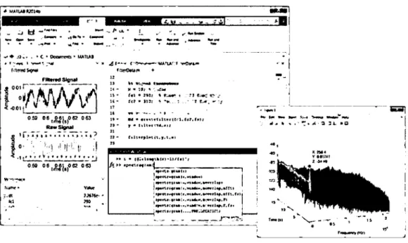 Figura  19:  Visualización del programa Matlab 