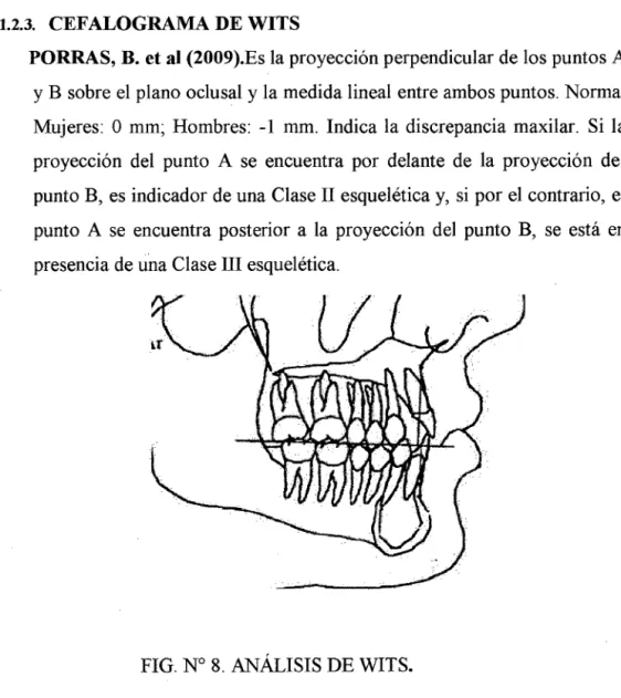 FIG. N° 8.  ANÁLISIS DE WITS. 