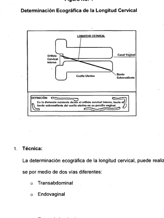 Figura No.  1 