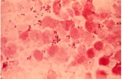 Figura 5: Tinción Gram de Staphylococcus aureus. 