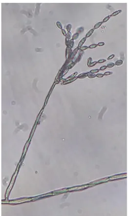 Fig. 16. Hifa, conidióforos y conidios ovoides catenulados de Cladosporium sp, en meristemos  de higuera