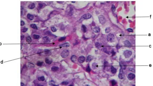 Fig. 5.  Pars Distalis o lóbulo anterior celular de la hipófisis.  Compuesta de cordones o  grupos de células epiteliales que pueden ser teñidas diferencialmente en acidófilas y  basófilas