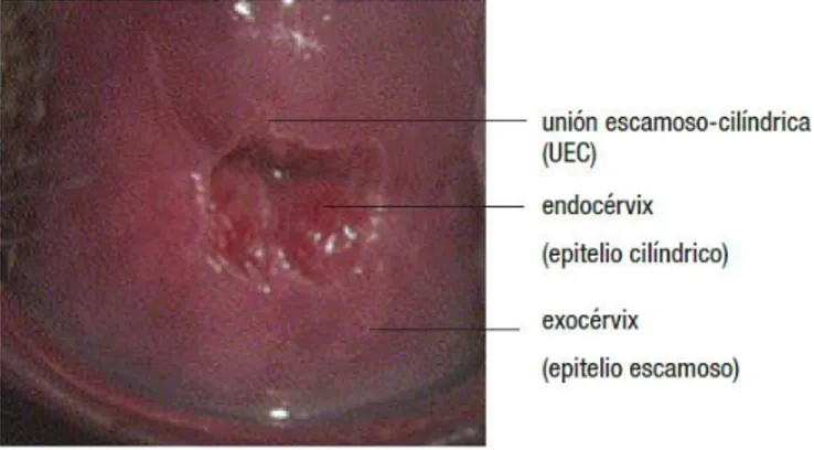 Figura 2.2.1.1: Cuello uterino 
