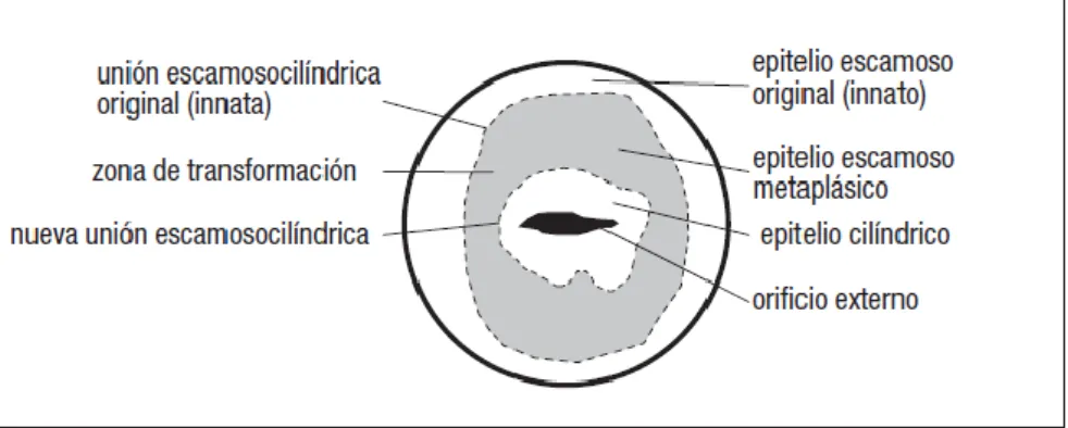 Figura 2.2.1.2: La zona de transformación del cuello uterino de una mujer en edad fecunda no nulípara 