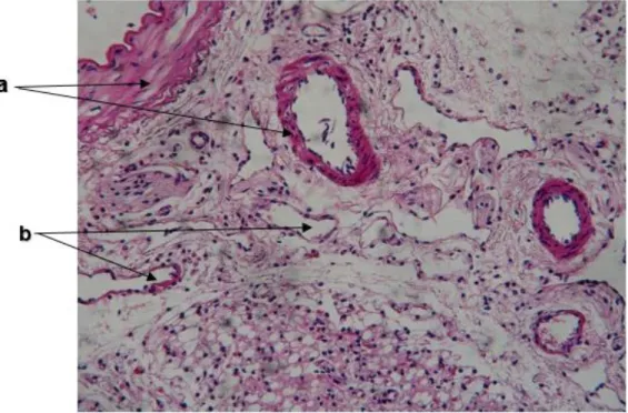 Fig. 5.  Detalle histológico de la afinidad al colorante Ácido Carmínico-Eosina de  los  componentes  estructurales  de  los  vasos  sanguíneos  renales  de  ovino