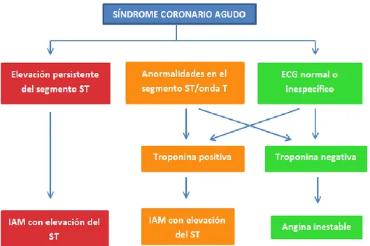 Figura I: Clasificación del Síndrome Coronario Agudo 