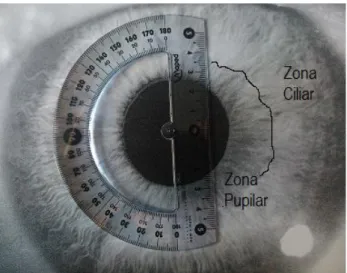 Figura 9. La fotografía muestra la zona ciliar y la zona pupilar del iris. Sobre el centro de la pupila se  sitúa el transportador indicando en grados la posición de la cripta