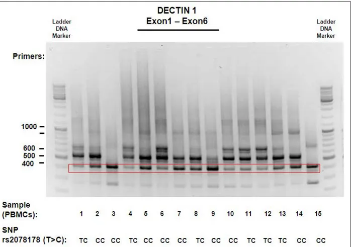 Figura 12. Transcritos y genotipo de Dectin-1 de los donantes sanos evaluados. Muestra representativa de las  27 muestras evaluadas