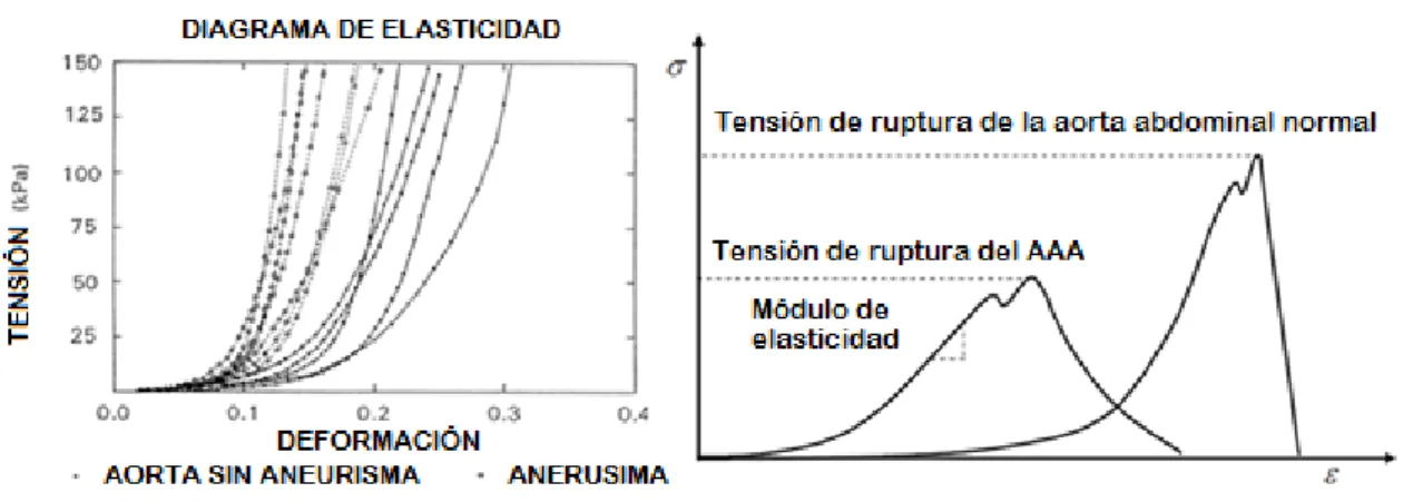 Figura 1-6. Diagrama de elasticidad de paredes de aorta con y sin aneurisma. 