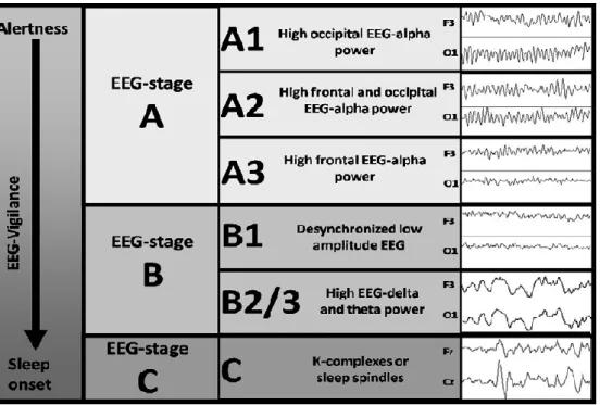 Figura  3.  EEG  vigilancia  dentro  de  un  continuo  de  alto  y  bajo  nivel  de  vigilancia