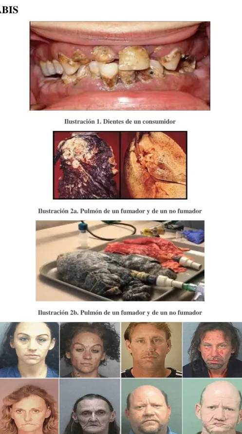 Ilustración 1. Dientes de un consumidor 
