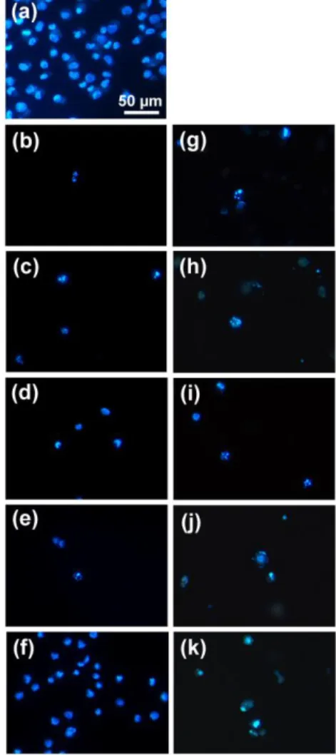 Fig. 6  Acridine  orange  staining  on  melanoma  (A375)  human  cancer  cell  line. a) Untreated (control) cells; b)-k) cells treated with compounds 1-10