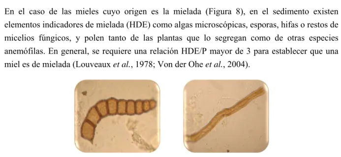 Figura 8. Elementos de mielada vistos al microscopio.  