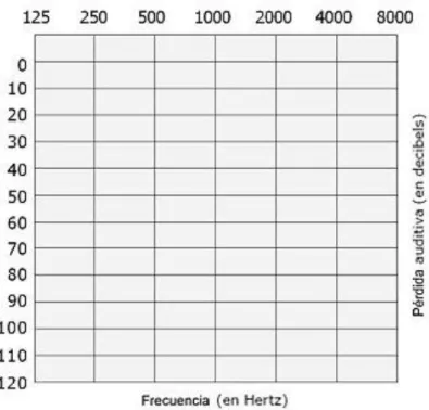 Figura 1. Gráfico audiométrico o audiograma.  