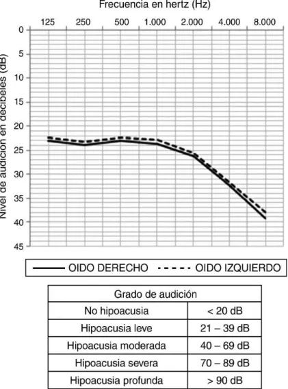 Figura  7.  Tendencia  promedio  de  la  curva  audiométrica  en  pacientes  con  diagnóstico  confirmado de diabetes tipo 1 y 2