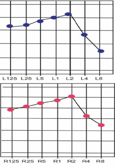 Figura  8. Tendencia promedio de la curva audiométrica en pacientes con diagnóstico confirmado de  diabetes tipo 2