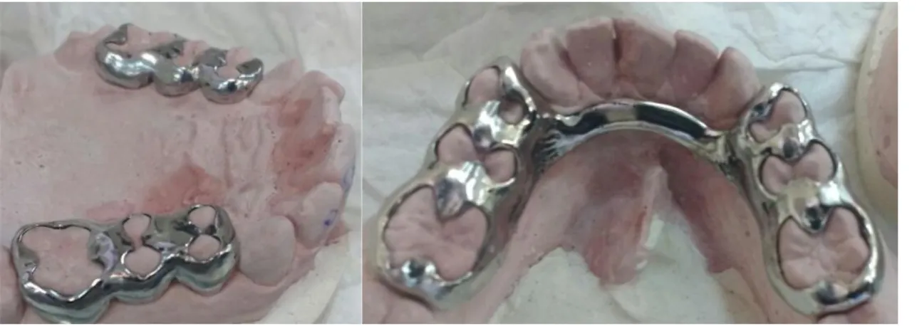 Figura  2. Estructura de cromo cobalto 