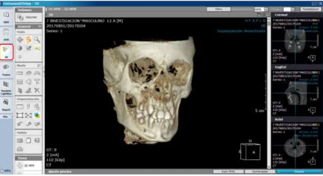 Figura 6: Utilización del módulo 3D del software OnDemand 3D  
