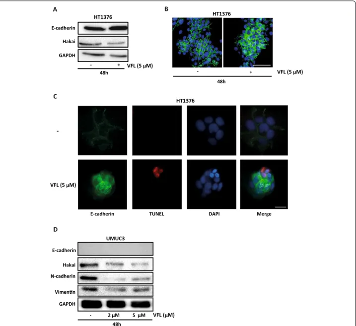 Figure 5 Effect of VFL on epithelial differentiation and apoptosis. A, Western blot analysis of E-cadherin and Hakai expression levels in HT1373 bladder tumour cells treated with 5 μM VFL for 48 h