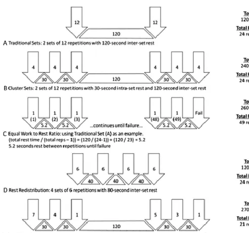 Figure 2. Representation of traditional (A) and cluster set schemes (B,C,D,E) Arrows indicate a number of repetitions  performed in sequence, triangles indicate intraset or inter-repetition rest periods and quadrilateral shapes indicate  interset rest peri