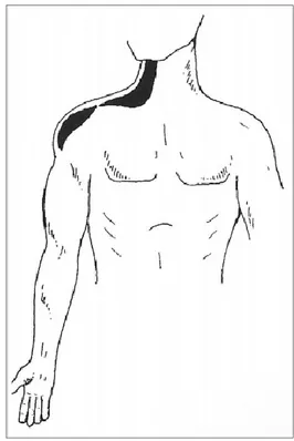 Fig.  9.  Cadena  anterointerna  del  hombro,  según  P. 