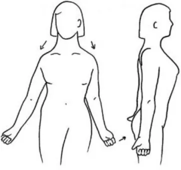 Fig.  13.  Ejercicio  postural  para  postura  de  cabeza  hacia  delante  y  hombros  enrollados  (Liebenson  C