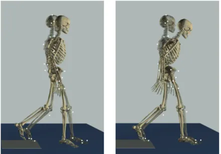 Figure 3. Postures of the model at the end of the simulation without control of the  longitudinal coordinate of the lumbar joint (left) and in the case of substituting, in the 