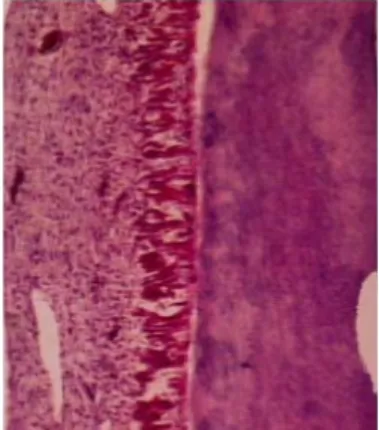 Figura  3.  30 días después de la restauración. El tejido pulpar expuesto características histológicas  normales (100 x)  tomada de: Rendjova V, Gjorgoski I, Ristoski T, Apostolska S