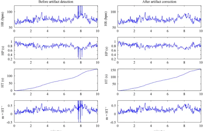 Fig. 2 shows an example where the different spectra and the corresponding indices are presented for a patient in the OSA group (a01) and for a patient in the control group (c01) using the  peri-odogram