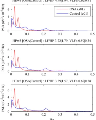 Fig. 2. Typical example of the resulting spectra and the corresponding LF/HF and VLFn indices for a patient in the OSA group (a01) and for a patient in the control group (c01) using the periodogram with cubic splines interpolation.