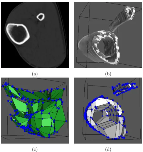 Figure 3.17: Image with several objects. (a) Slice of the CT images set. (b) 3D represen- represen-tation of the tibia and fibula