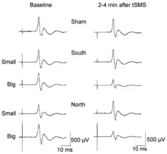 Figure 4. Experiment 1. Time course of  the effects of the different kinds of  tSMS and of sham stimulation on  normalized MEPs 