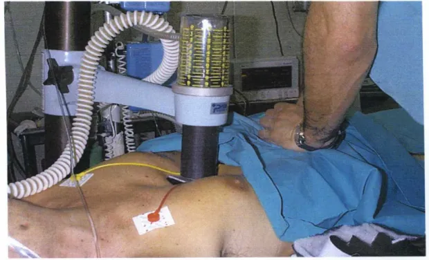 Foto 1. Masaj e cardíaco externo mediante cardiocompresor.