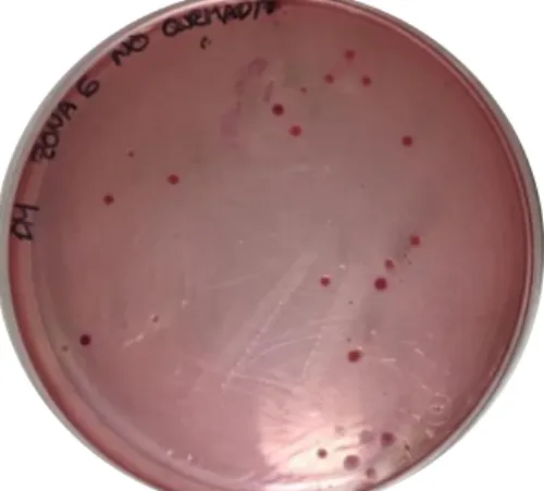 Figura 2. Agar VRBG con crecimiento de colonias rojo-rosadas que corresponden a enterobacterias