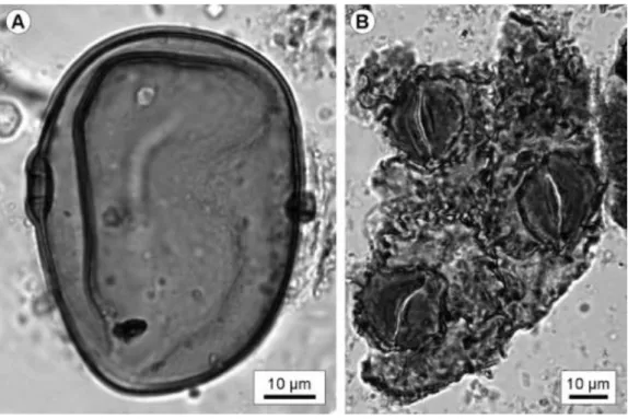 Fig. 4. Microphotographs  of  keystone  palynomorphs.  A)  Pollen  of Secale  cereale from  a  sample  situated  at  80 cm  depth