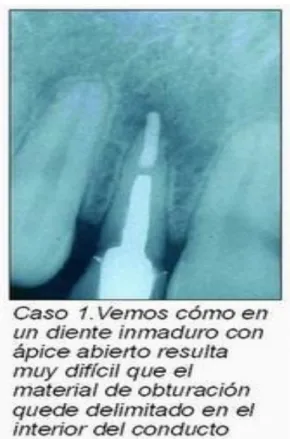 Gráfico 2: Caso 1 