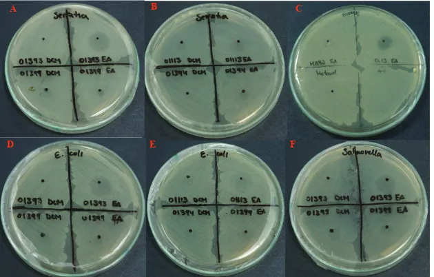 Figura 11. Resultados del ensayo de inhibición bacteriana con el método por difusión directa en el agar