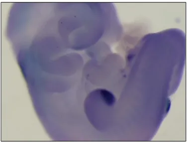 Figura 1.3. Hibridización in situ de bloque completo de embrión de ratón silvestre (E10) en la que se observa la expresión intensa de Shh en la ZAP (zona de actividad polarizada) de los miembros inferiores