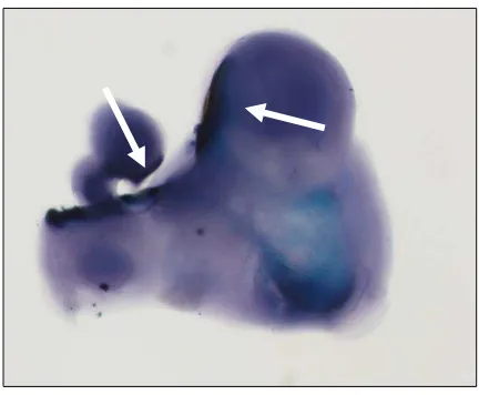 Figura 1.4. Hibridación in situ de bloque completo de la cabeza de un embrión de ratón silvestre (E10) en la que se 