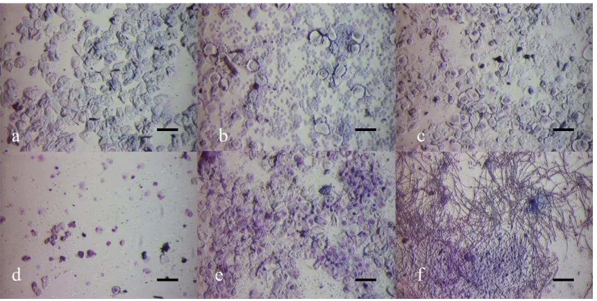 Figura 2.7. Imágenes de microscopía de luz 10X, de la celularidad encontrada en los frotis vaginales